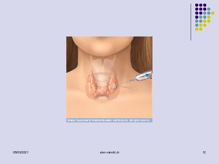 05/03/2021 alen vukelić, dr 12 