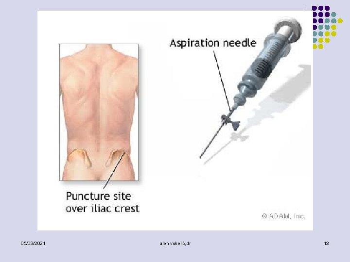 05/03/2021 alen vukelić, dr 13 
