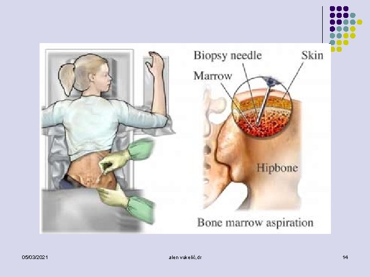 05/03/2021 alen vukelić, dr 14 