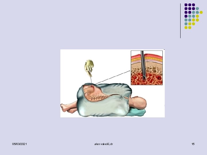 05/03/2021 alen vukelić, dr 15 