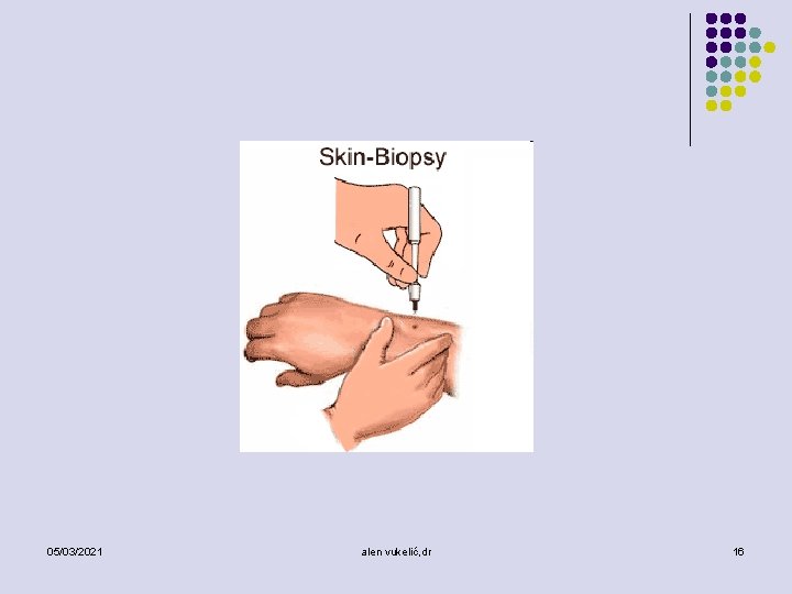 05/03/2021 alen vukelić, dr 16 