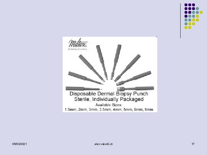 05/03/2021 alen vukelić, dr 17 