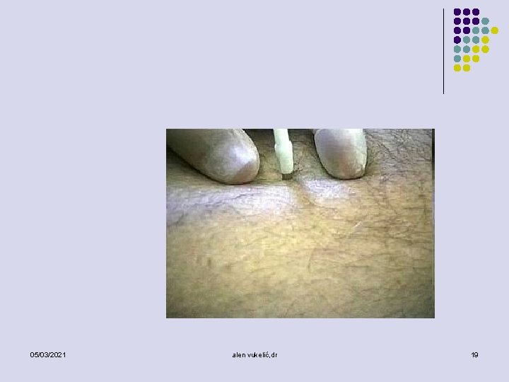 05/03/2021 alen vukelić, dr 19 