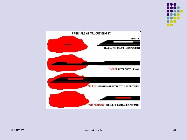 05/03/2021 alen vukelić, dr 20 