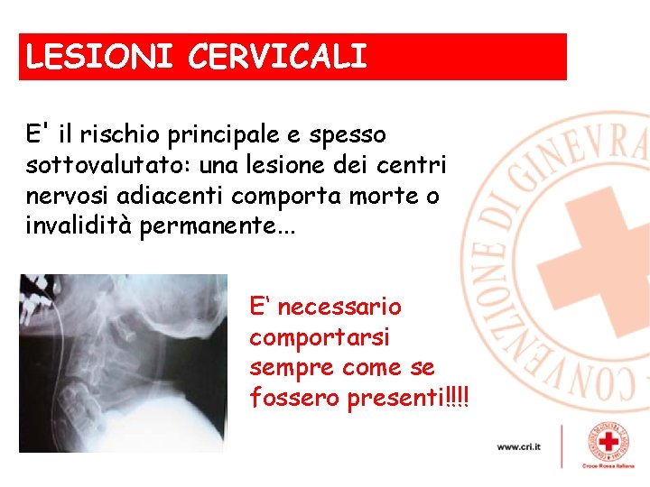 LESIONI CERVICALI , E' il rischio principale e spesso sottovalutato: una lesione dei centri