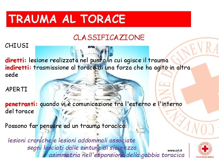 TRAUMA AL TORACE , CHIUSI CLASSIFICAZIONE diretti: lesione realizzata nel punto in cui agisce