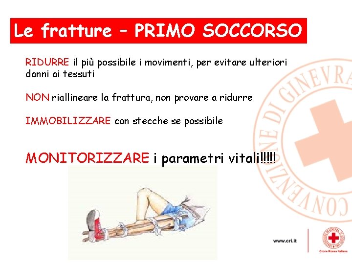 Le fratture – PRIMO , SOCCORSO RIDURRE il più possibile i movimenti, per evitare