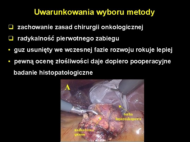 Uwarunkowania wyboru metody q zachowanie zasad chirurgii onkologicznej q radykalność pierwotnego zabiegu • guz