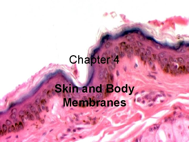 Chapter 4 Skin and Body Membranes 