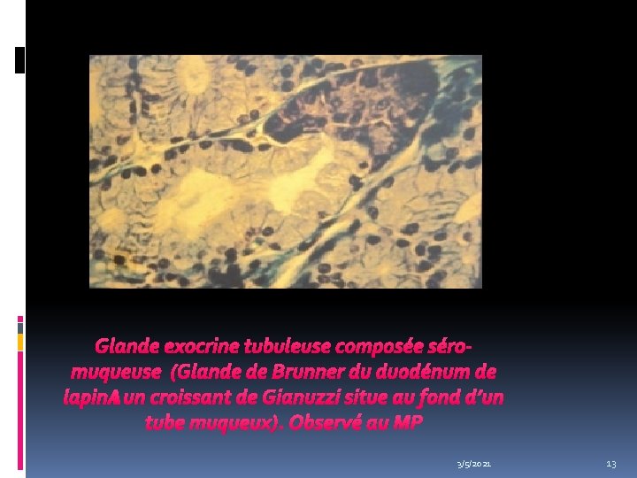 Glande exocrine tubuleuse composée séromuqueuse (Glande de Brunner du duodénum de lapin : un