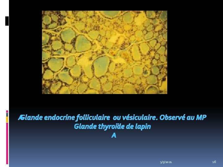  Glande endocrine folliculaire ou vésiculaire. Observé au MP Glande thyroïde de lapin 3/5/2021