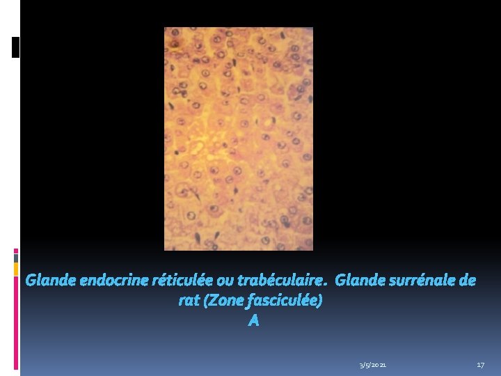 Glande endocrine réticulée ou trabéculaire. Glande surrénale de rat (Zone fasciculée) 3/5/2021 17 