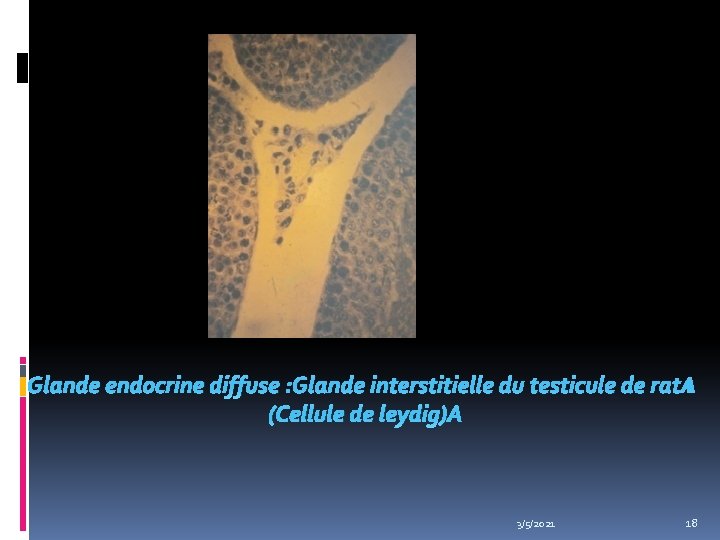 Glande endocrine diffuse : Glande interstitielle du testicule de rat : (Cellule de leydig)