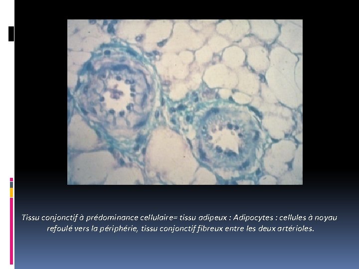 Tissu conjonctif à prédominance cellulaire= tissu adipeux : Adipocytes : cellules à noyau refoulé