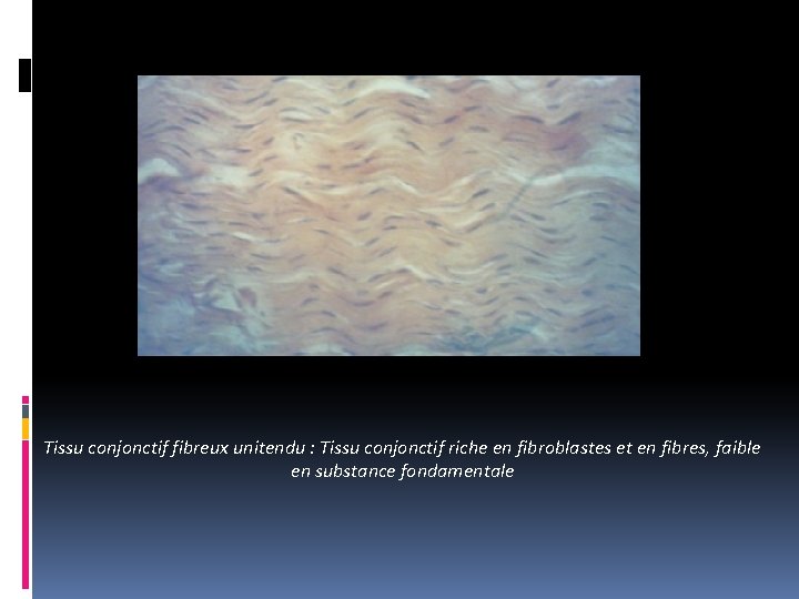 Tissu conjonctif fibreux unitendu : Tissu conjonctif riche en fibroblastes et en fibres, faible