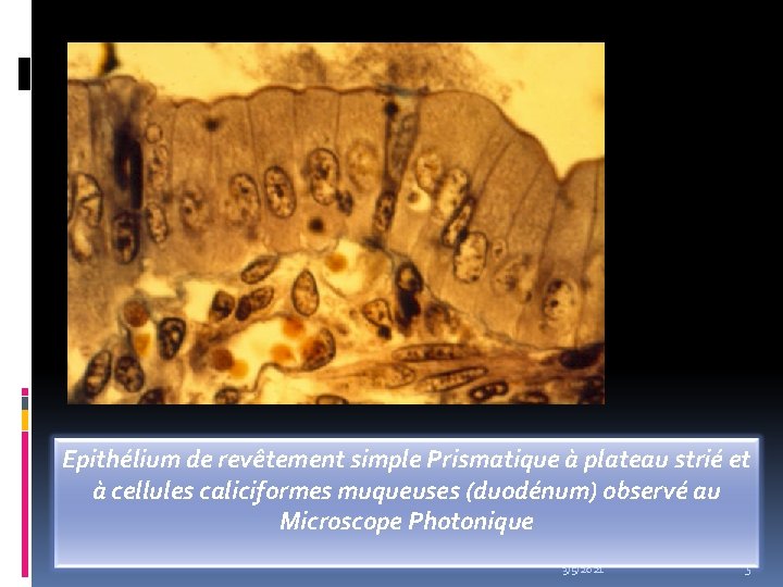 Epithélium de revêtement simple Prismatique à plateau strié et à cellules caliciformes muqueuses (duodénum)
