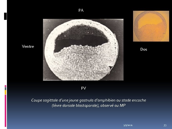 PA Ventre Dos PV Coupe sagittale d’une jeune gastrula d’amphibien au stade encoche (lèvre