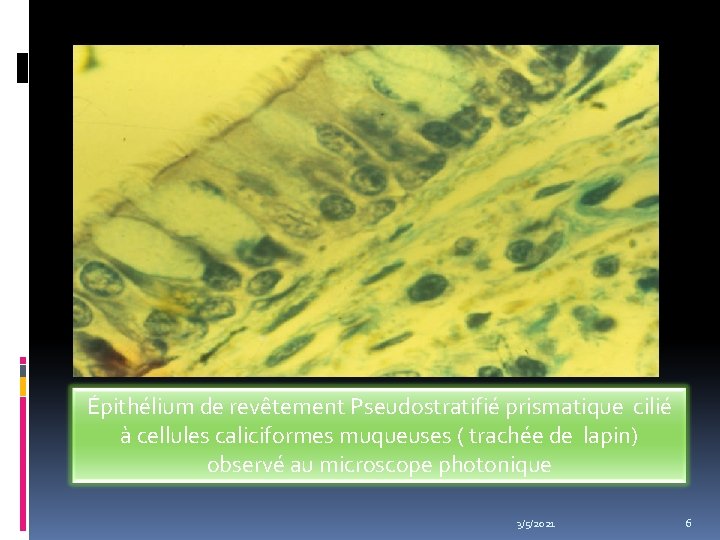 Épithélium de revêtement Pseudostratifié prismatique cilié à cellules caliciformes muqueuses ( trachée de lapin)