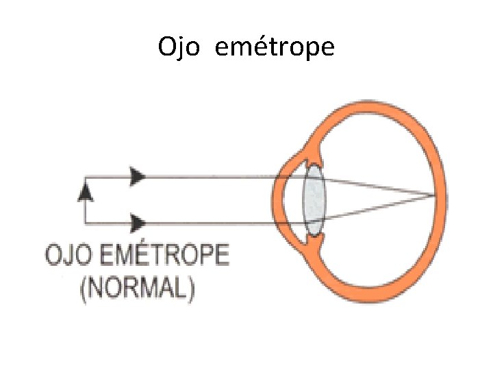 Ojo emétrope 