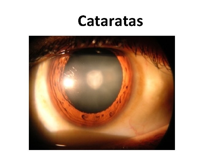 Cataratas 