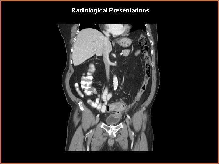 Radiological Presentations 