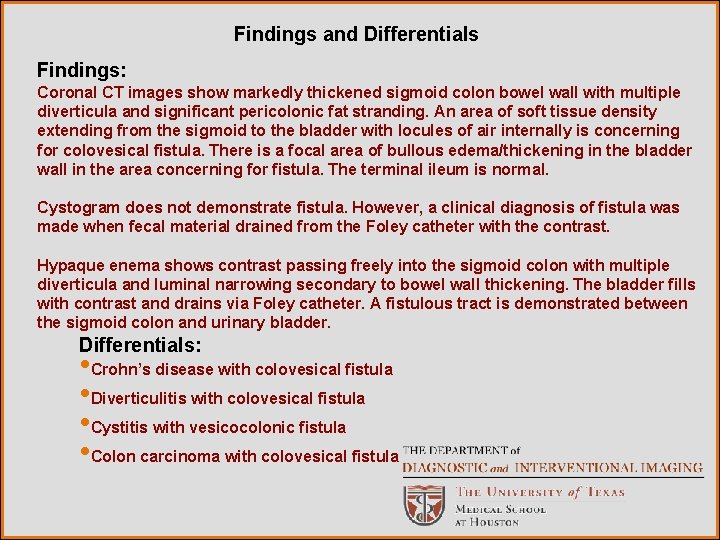 Findings and Differentials Findings: Coronal CT images show markedly thickened sigmoid colon bowel wall