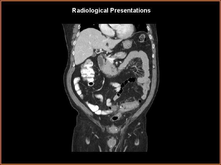 Radiological Presentations 