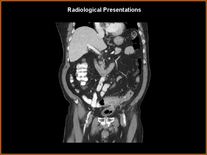 Radiological Presentations 