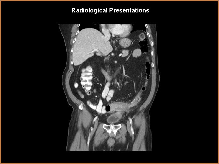 Radiological Presentations 