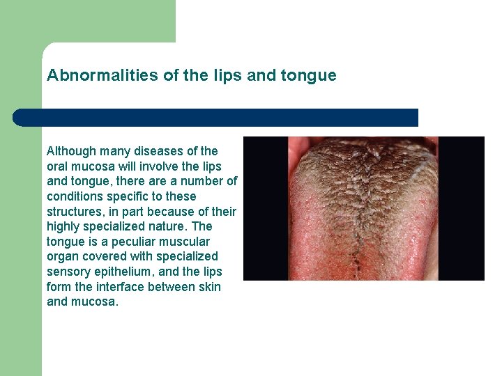 Abnormalities of the lips and tongue Although many diseases of the oral mucosa will Abnormalities of the lips and tongue Although many diseases of the oral mucosa will