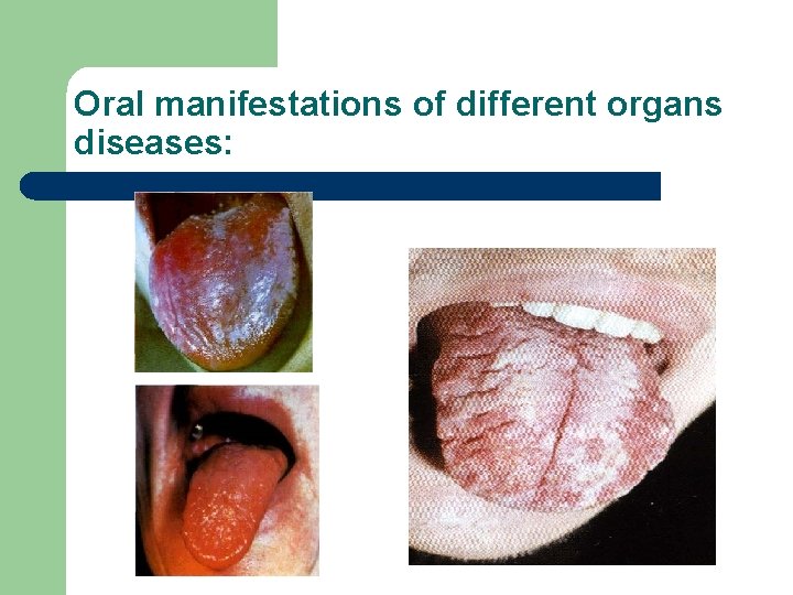 Oral manifestations of different organs diseases: Oral manifestations of different organs diseases: