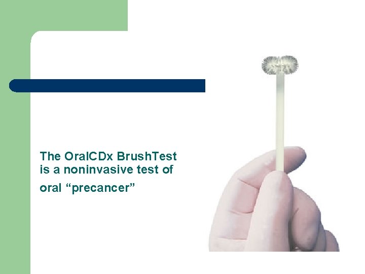 The Oral. CDx Brush. Test is a noninvasive test of oral “precancer” The Oral. CDx Brush. Test is a noninvasive test of oral “precancer”