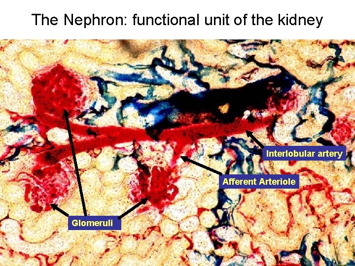 The Nephron: functional unit of the kidney Interlobular artery Afferent Arteriole Glomeruli 