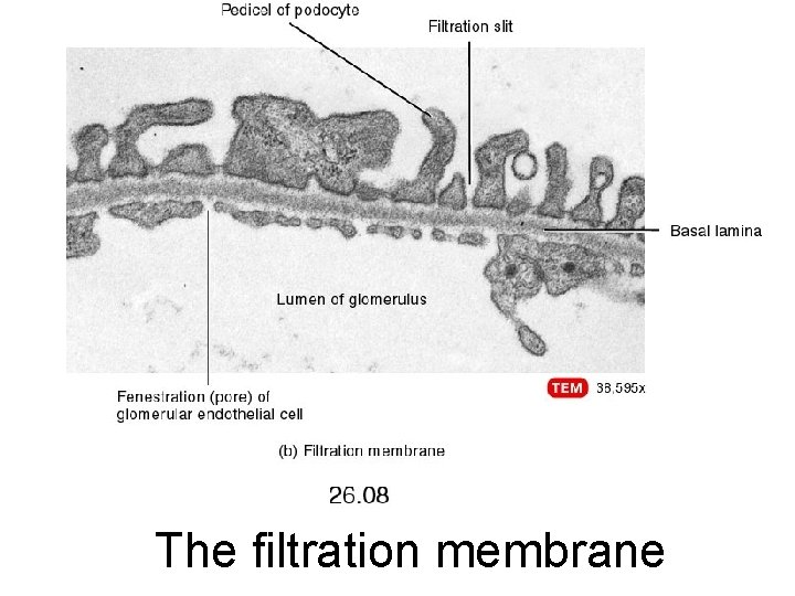 The filtration membrane 
