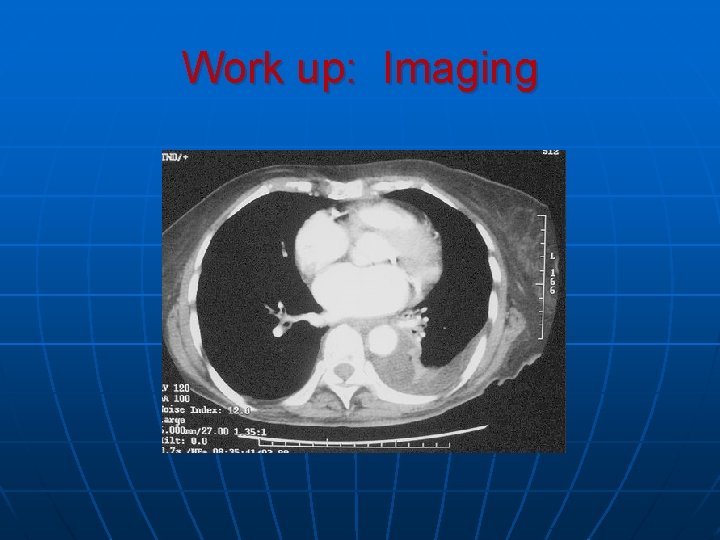 Work up: Imaging Work up: Imaging
