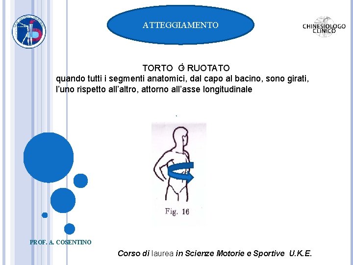 ATTEGGIAMENTO TORTO O; RUOTATO quando tutti i segmenti anatomici, dal capo al bacino, sono