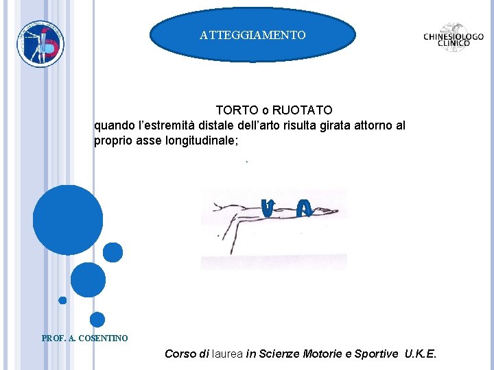 ATTEGGIAMENTO TORTO o RUOTATO quando l’estremità distale dell’arto risulta girata attorno al proprio asse