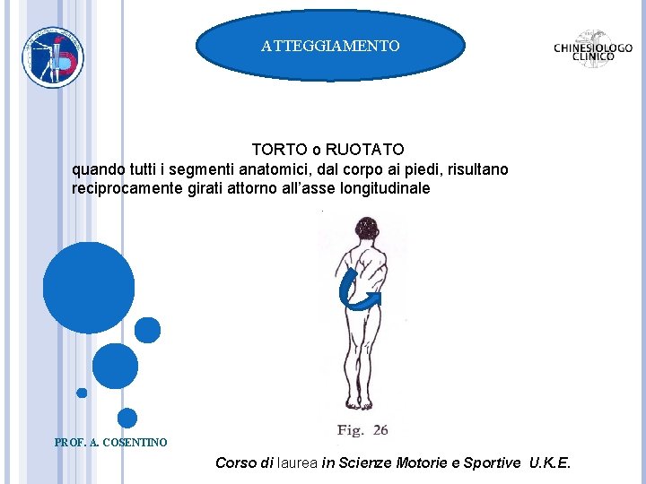 ATTEGGIAMENTO TORTO o RUOTATO quando tutti i segmenti anatomici, dal corpo ai piedi, risultano