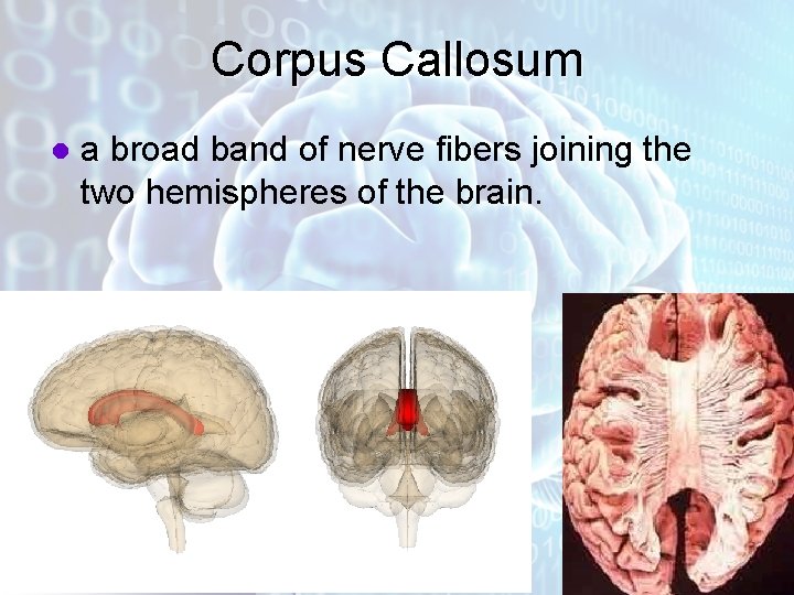 Corpus Callosum l a broad band of nerve fibers joining the two hemispheres of