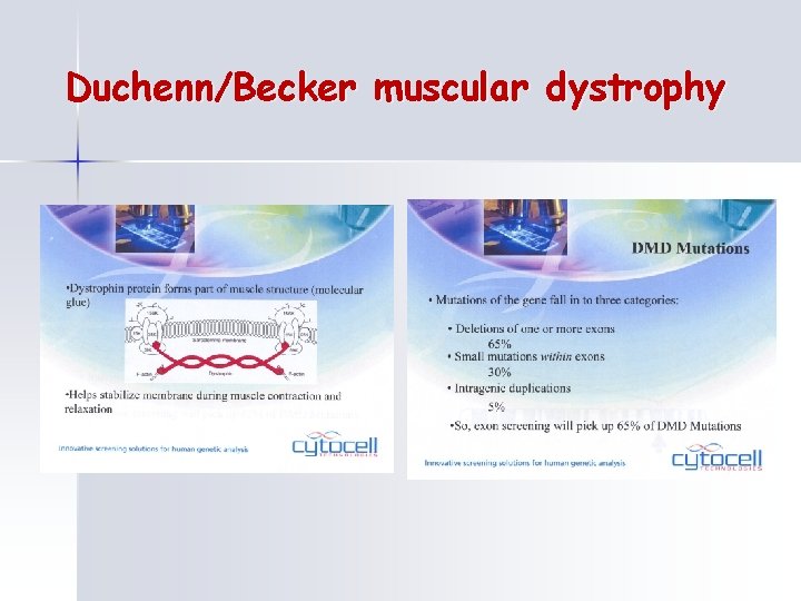 Duchenn/Becker muscular dystrophy 