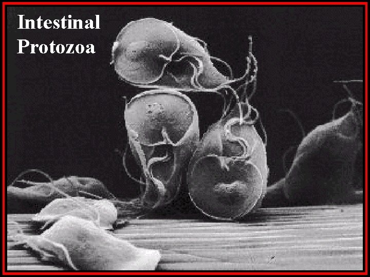 Intestinal Protozoa Intestinal Protozoa