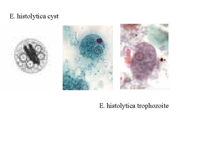 E. histolytica cyst E. histolytica trophozoite E. histolytica cyst E. histolytica trophozoite