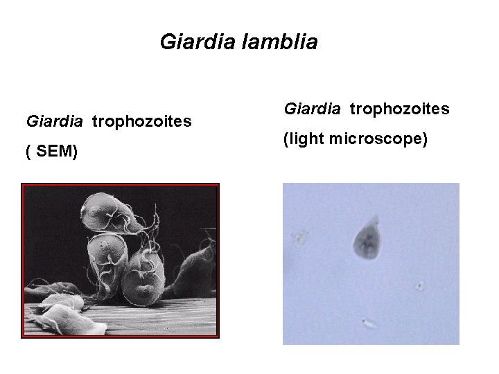 Giardia lamblia Giardia trophozoites ( SEM) Giardia trophozoites (light microscope) Giardia lamblia Giardia trophozoites ( SEM) Giardia trophozoites (light microscope)
