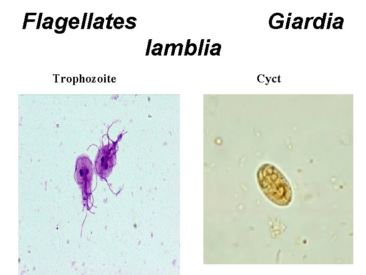 Flagellates Giardia lamblia Trophozoite Cyct Flagellates Giardia lamblia Trophozoite Cyct