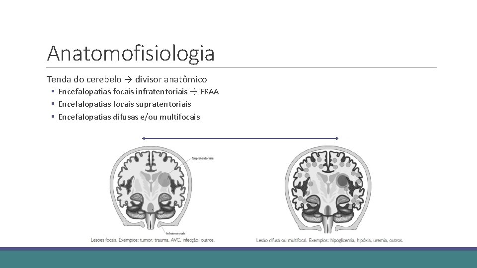 Anatomofisiologia Tenda do cerebelo → divisor anatômico § Encefalopatias focais infratentoriais → FRAA §