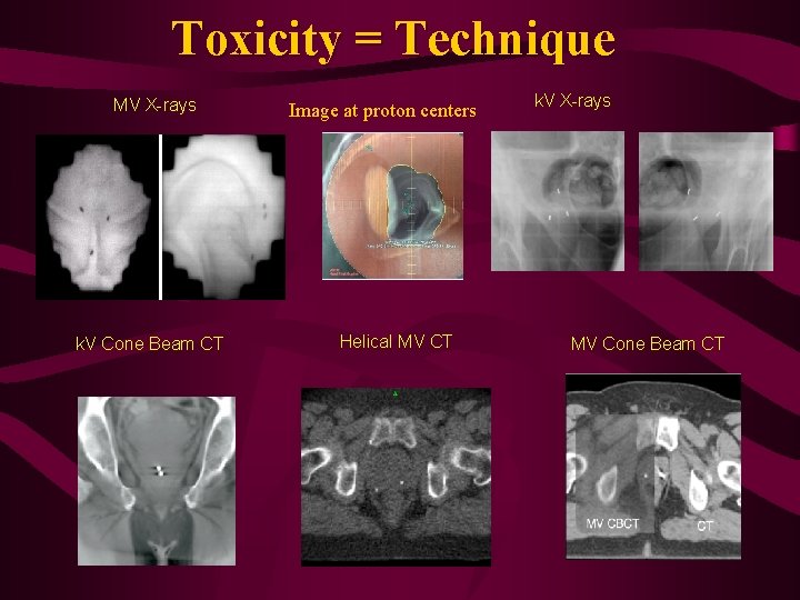 Toxicity = Technique MV X-rays k. V Cone Beam CT Image at proton centers