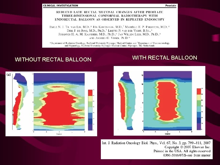 WITHOUT RECTAL BALLOON WITH RECTAL BALLOON 