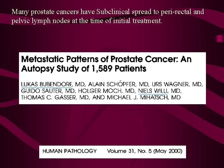 Many prostate cancers have Subclinical spread to peri-rectal and pelvic lymph nodes at the