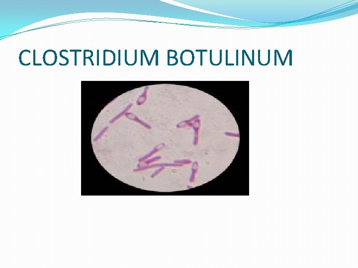 CLOSTRIDIUM BOTULINUM CLOSTRIDIUM BOTULINUM