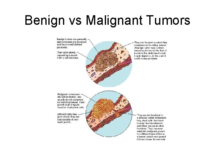 Benign vs Malignant Tumors 